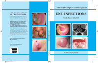 Vinidh&John_ENT Infections_Atlas_.pdf